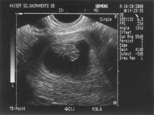 ius01.jpg