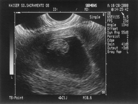 ius03.jpg